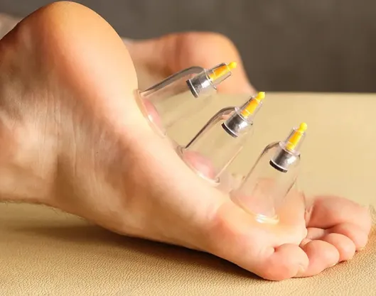 Feet Cupping Therapy